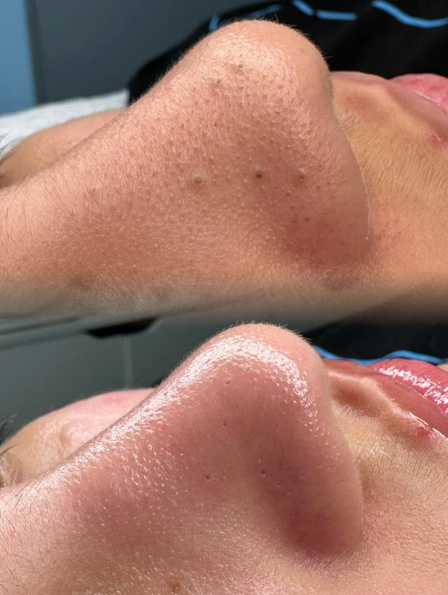 Nega lica — LAEL Beauty, Mladenovac
