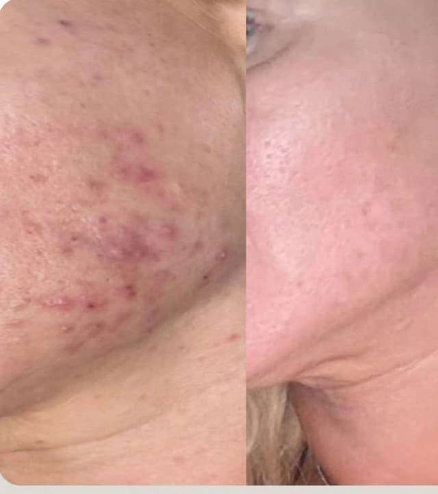 Nega lica — LAEL Beauty, Mladenovac