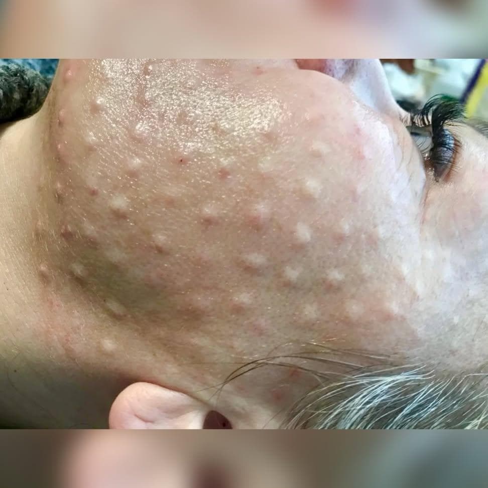 Nega lica i depilacija — LAEL Beauty, Mladenovac, fotografija 4