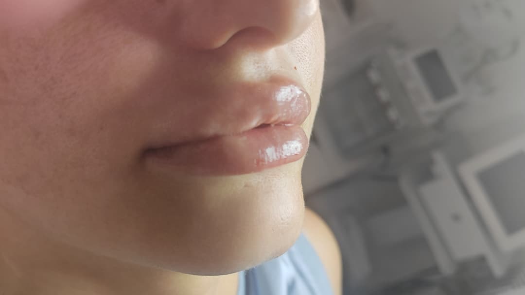 Nega lica i depilacija — LAEL Beauty, Mladenovac, fotografija 8