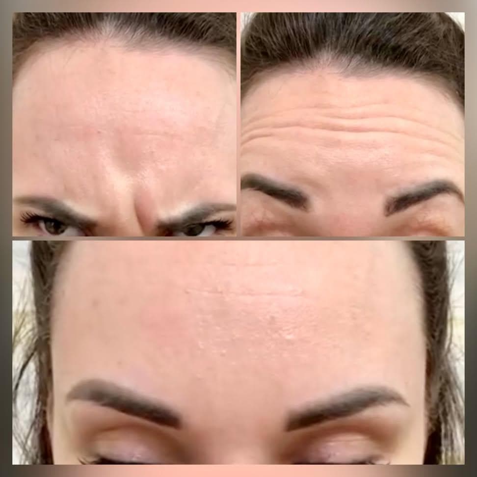Nega lica i depilacija — LAEL Beauty, Mladenovac, fotografija 5