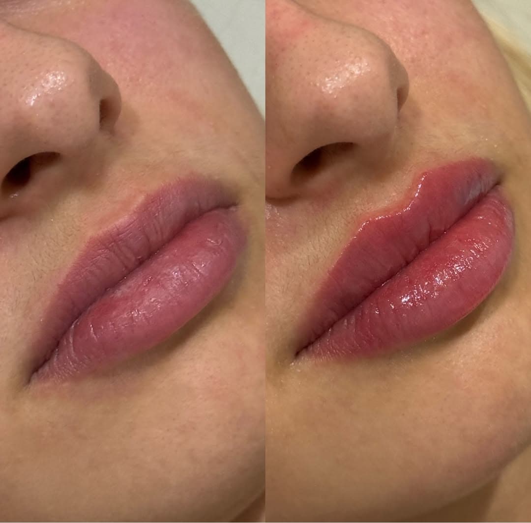 Nega lica i depilacija — LAEL Beauty, Mladenovac, fotografija 9