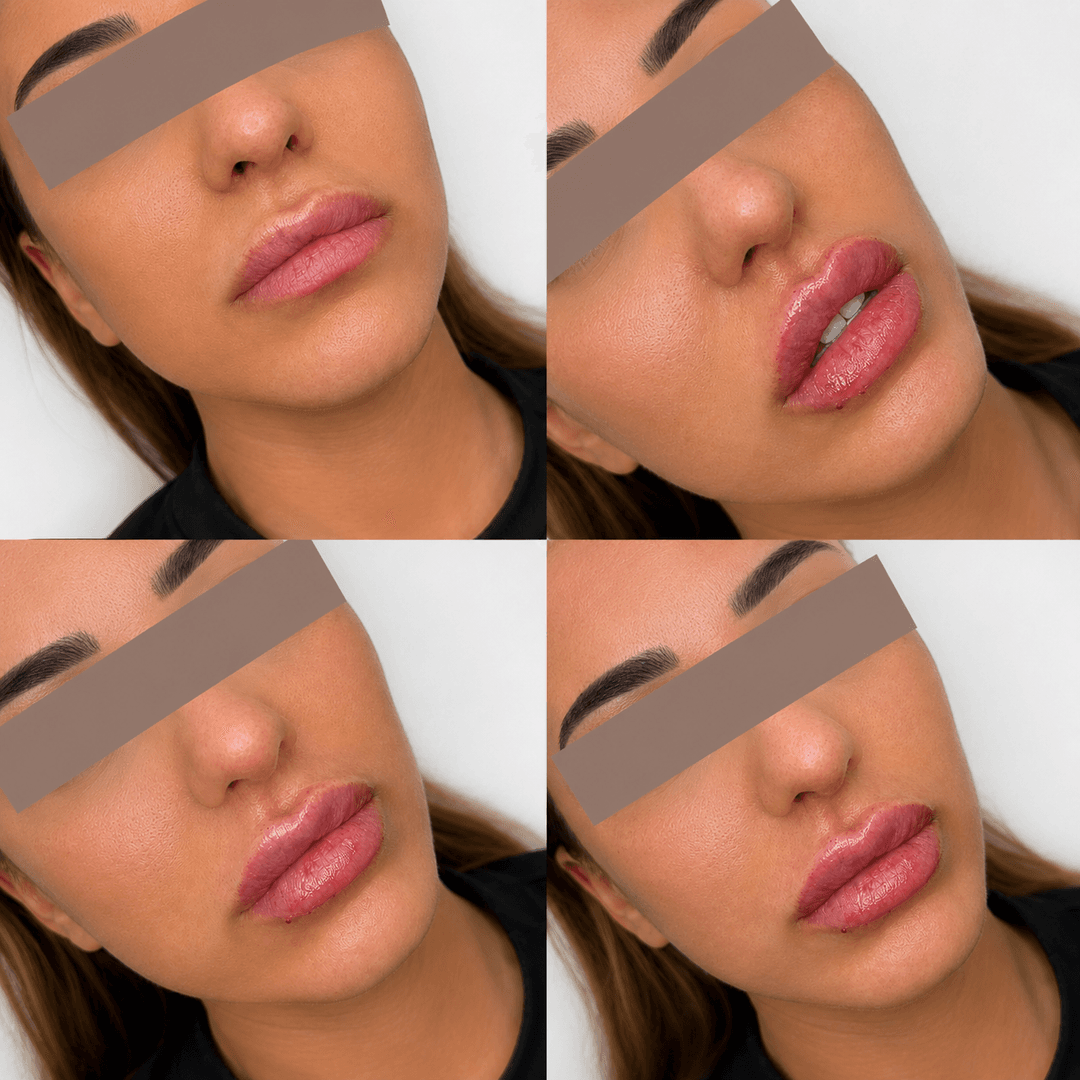 Nega lica i depilacija — LAEL Beauty, Mladenovac, fotografija 18