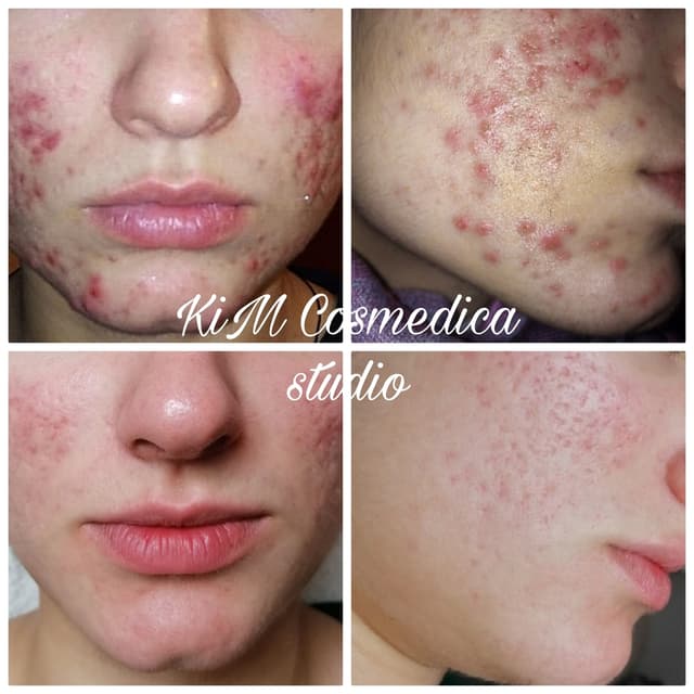 Nega lica — Kim Cosmedica studio, Stari grad