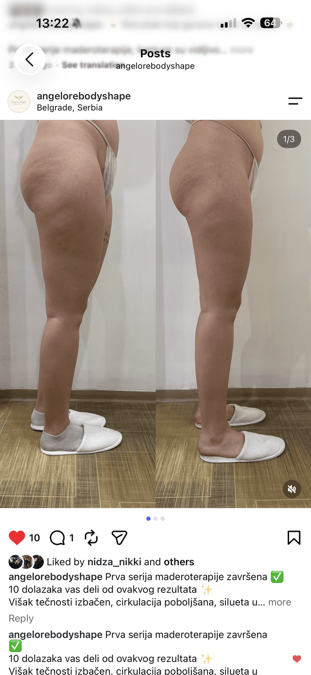 Masaža — Angelore body shape, Vukov spomenik
