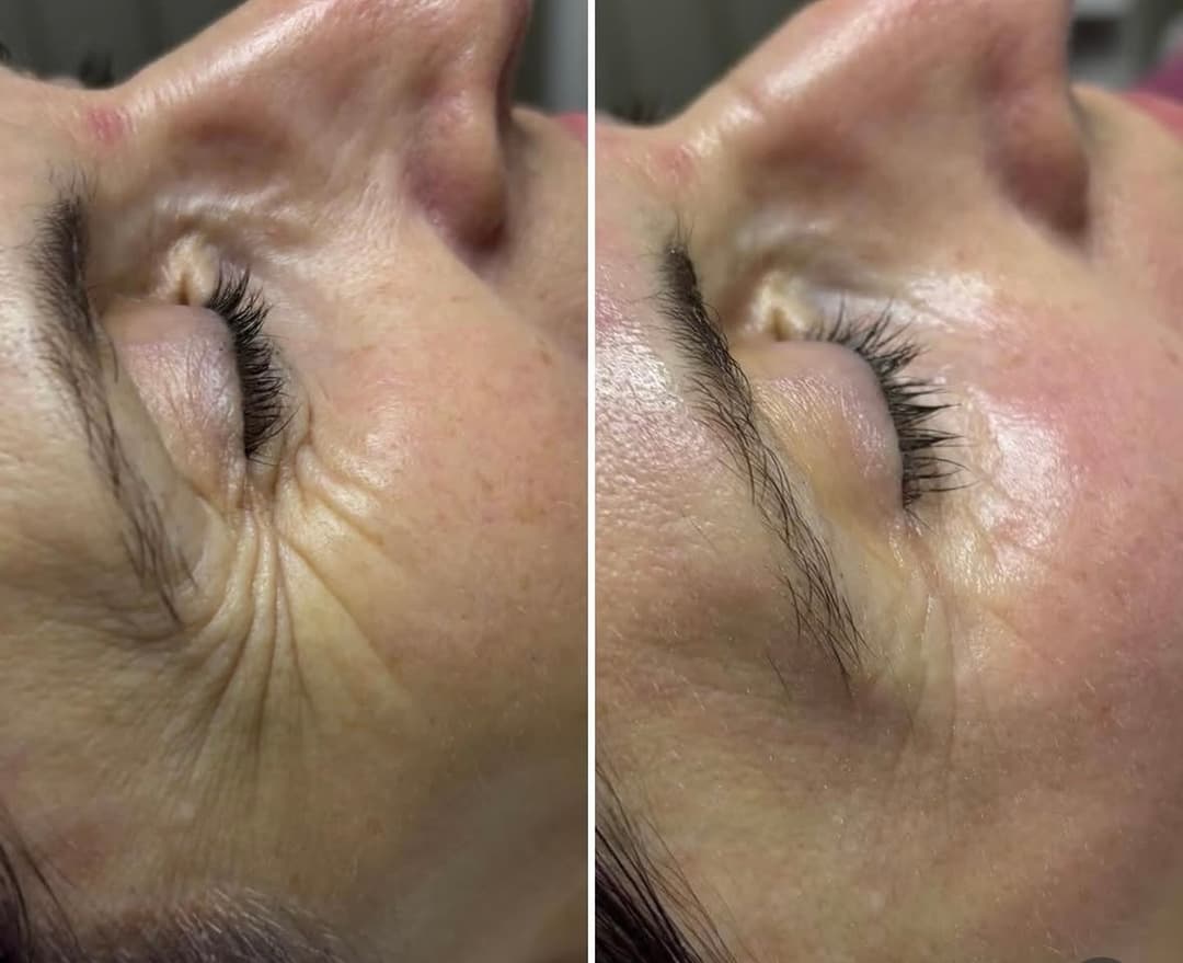 Nega lica i tretmani tela — Baby Face, Terazije, fotografija 5