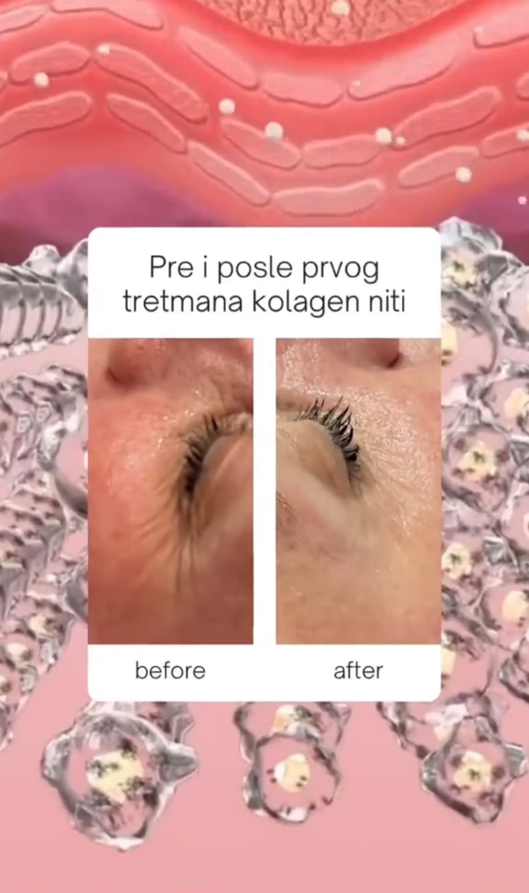 Nega lica i tretmani tela — Baby Face, Terazije, fotografija 7