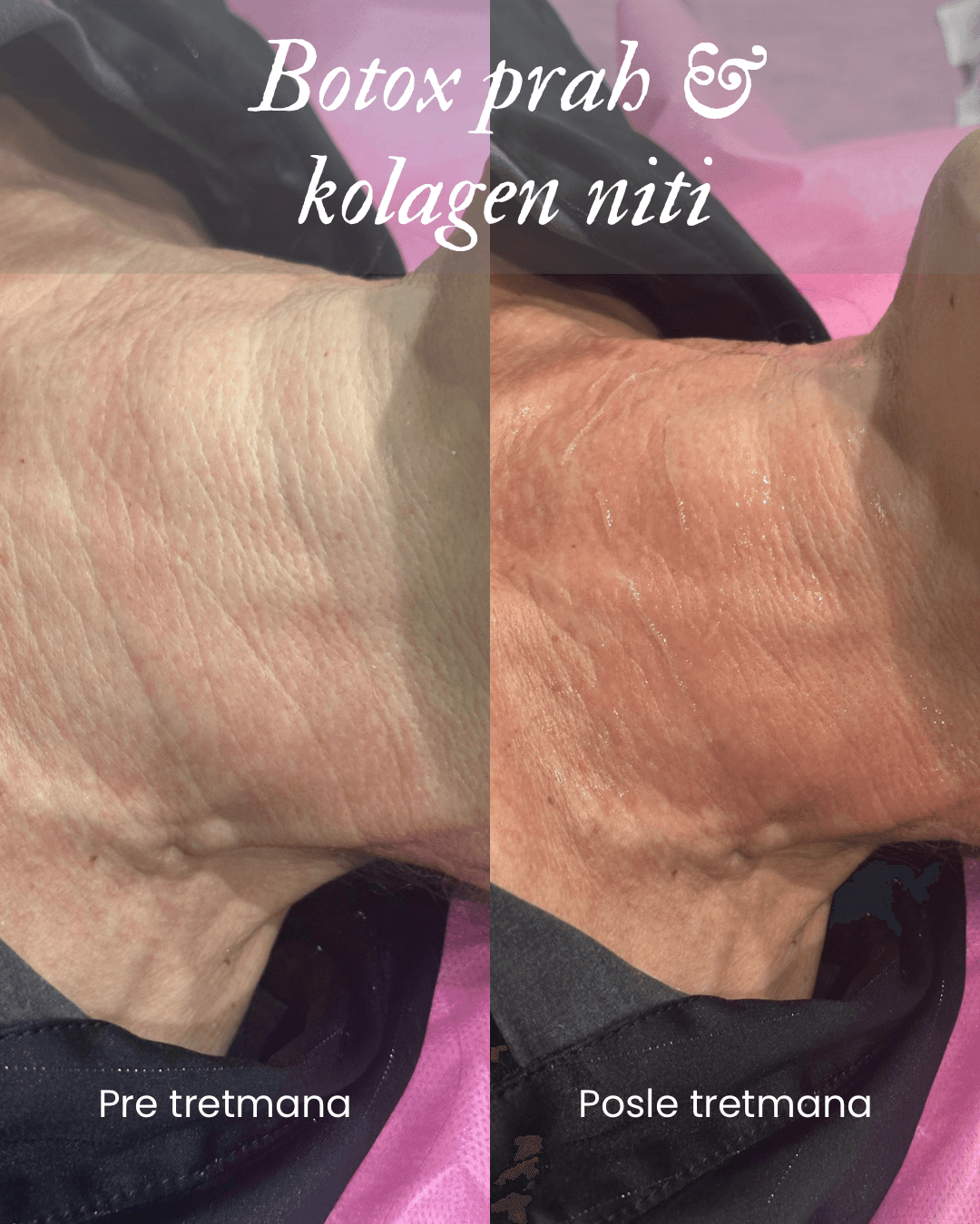 Nega lica i tretmani tela — Baby Face, Terazije, fotografija 11