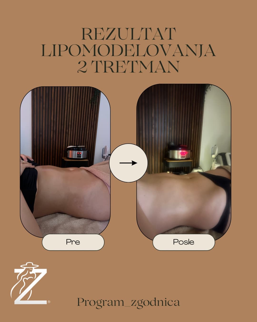 Masaža i tretmani tela — Zgodnica, Banjica, fotografija 7