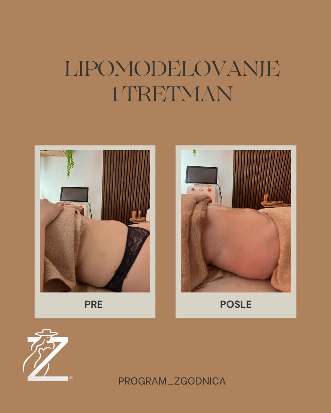 Masaža i tretmani tela — Zgodnica, Banjica, fotografija 8